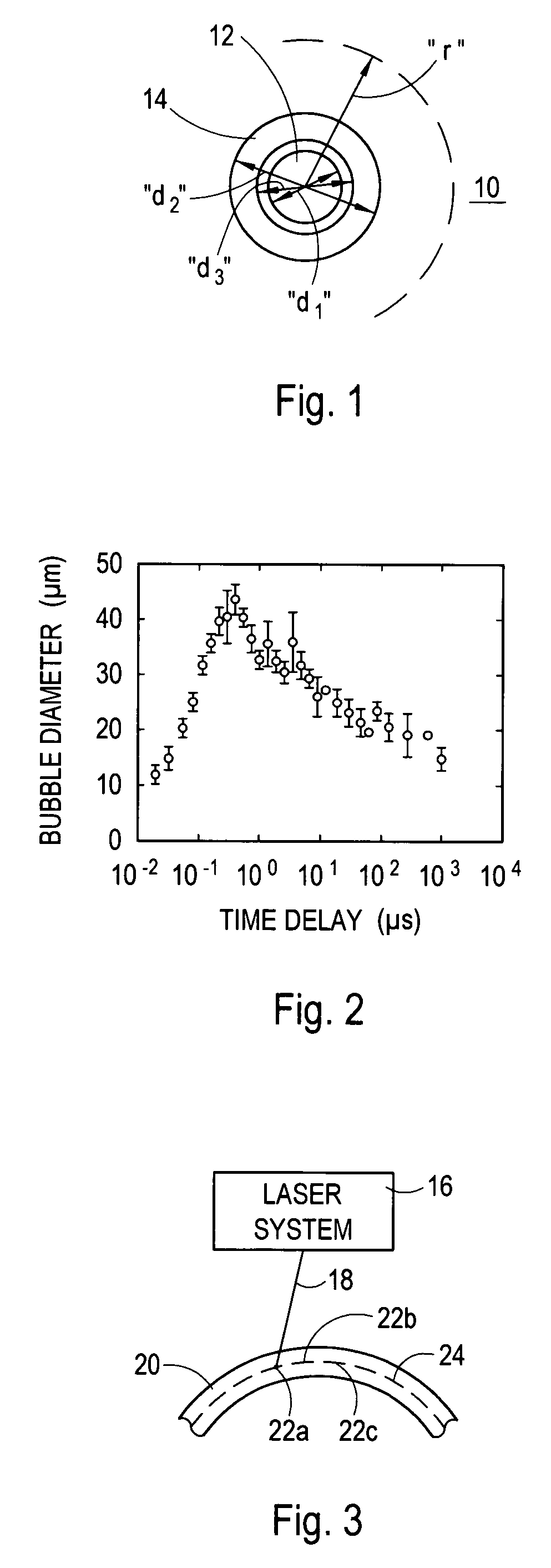 Time-resolved scanning patterns for intrastromal surgery