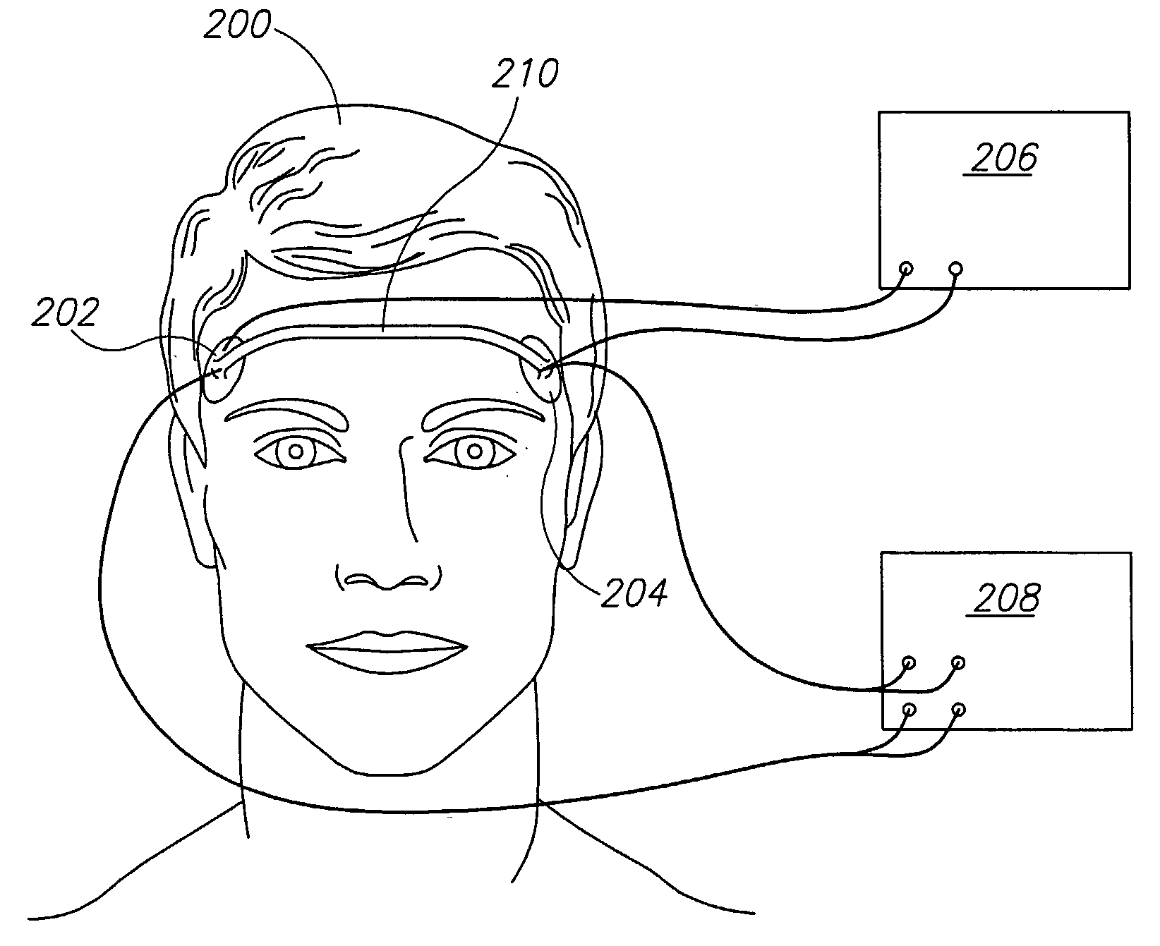 Cerebral Perfusion Monitor