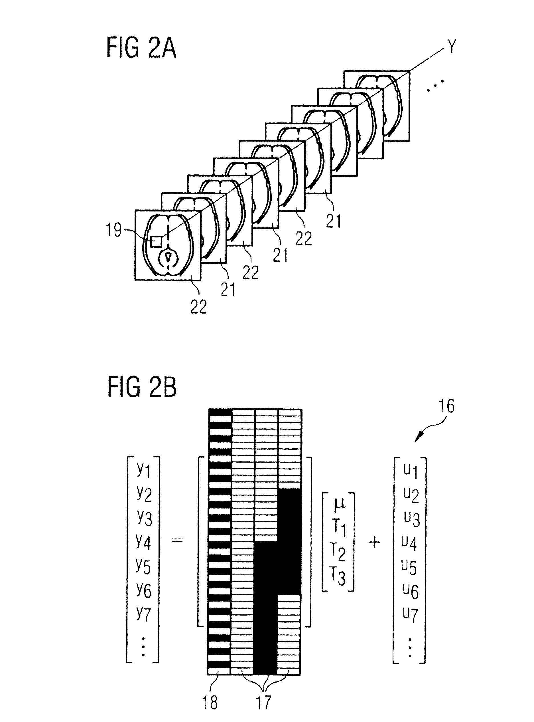 Magnetic resonance device and method for perfusion determination