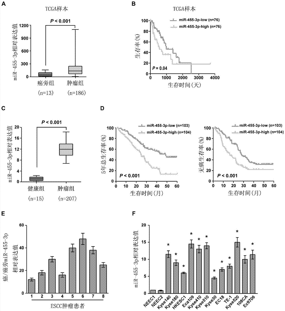 Application of mir‑455‑3p in the diagnosis, treatment and prognosis of esophageal squamous cell carcinoma