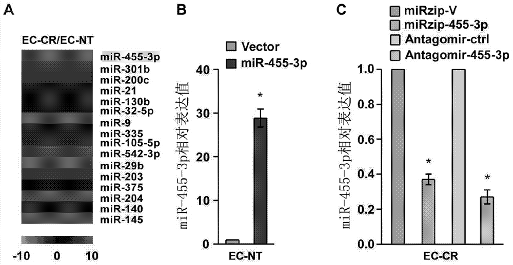 Application of mir‑455‑3p in the diagnosis, treatment and prognosis of esophageal squamous cell carcinoma