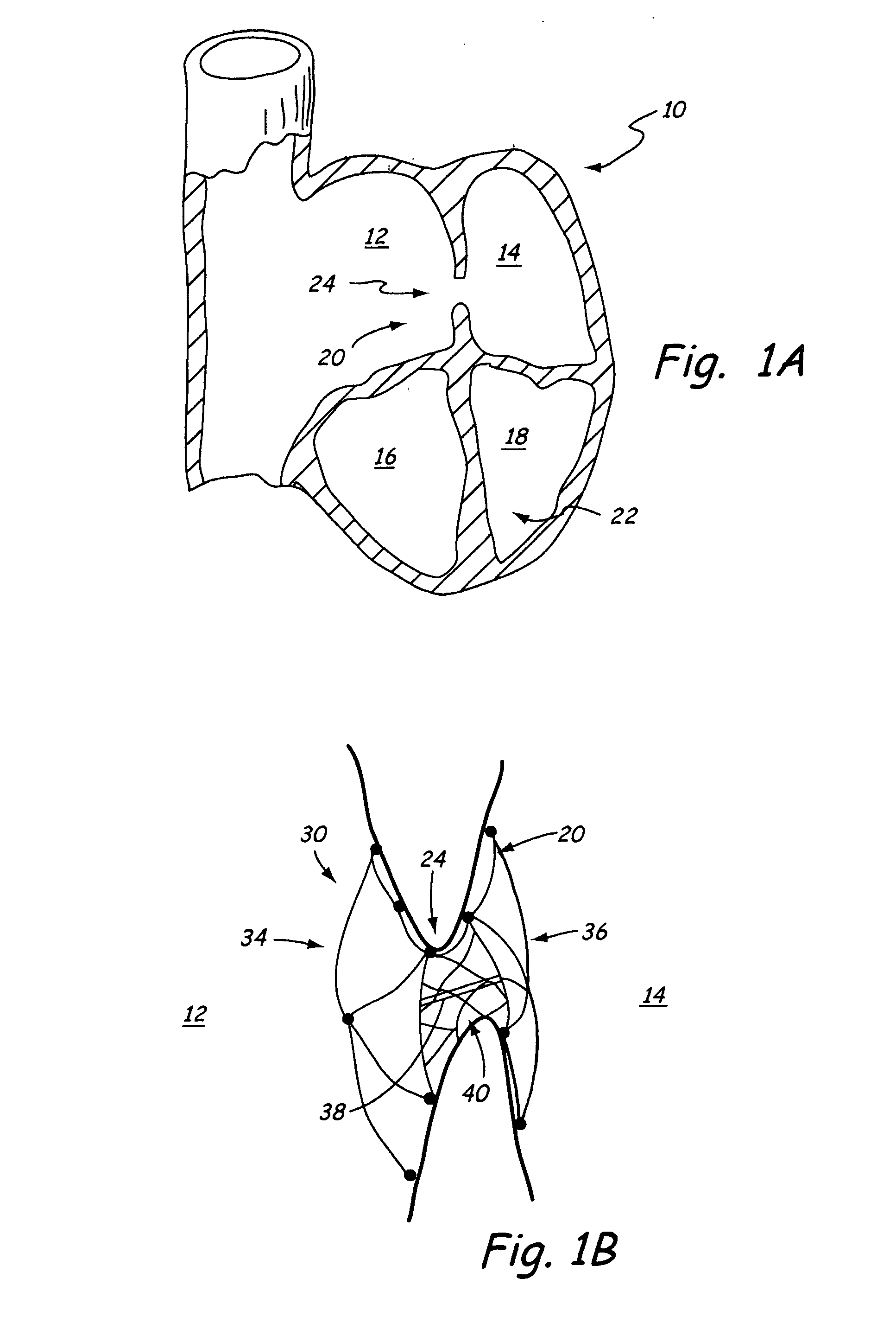 Self centering closure device for septal occlusion