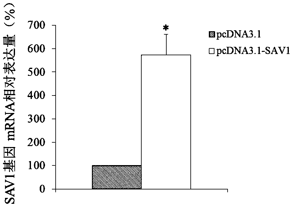 Use of SAV1 (Salvador family WW domain-containing protein 1) gene as hysteromyoma diagnostics and treatment marker