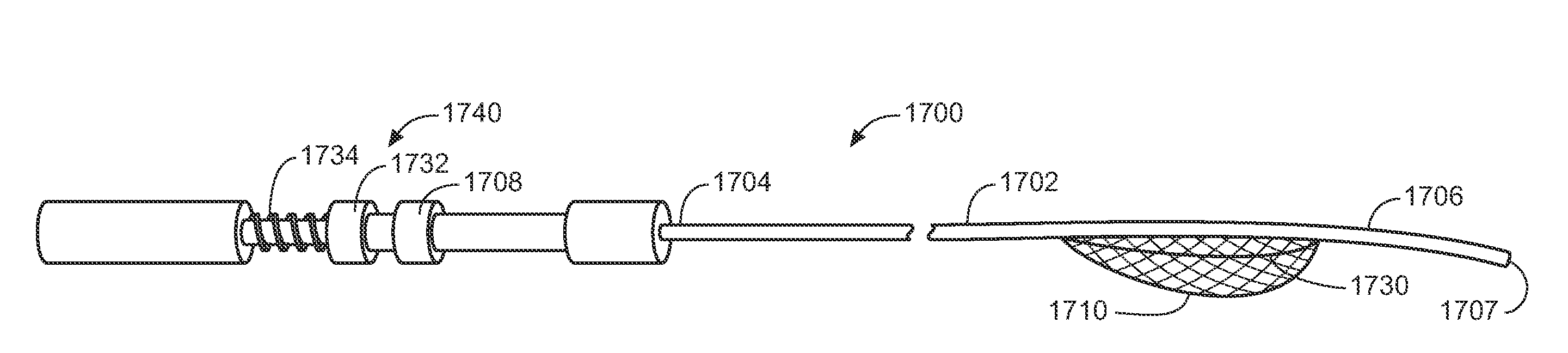 Endostapler Biasing Mechanism