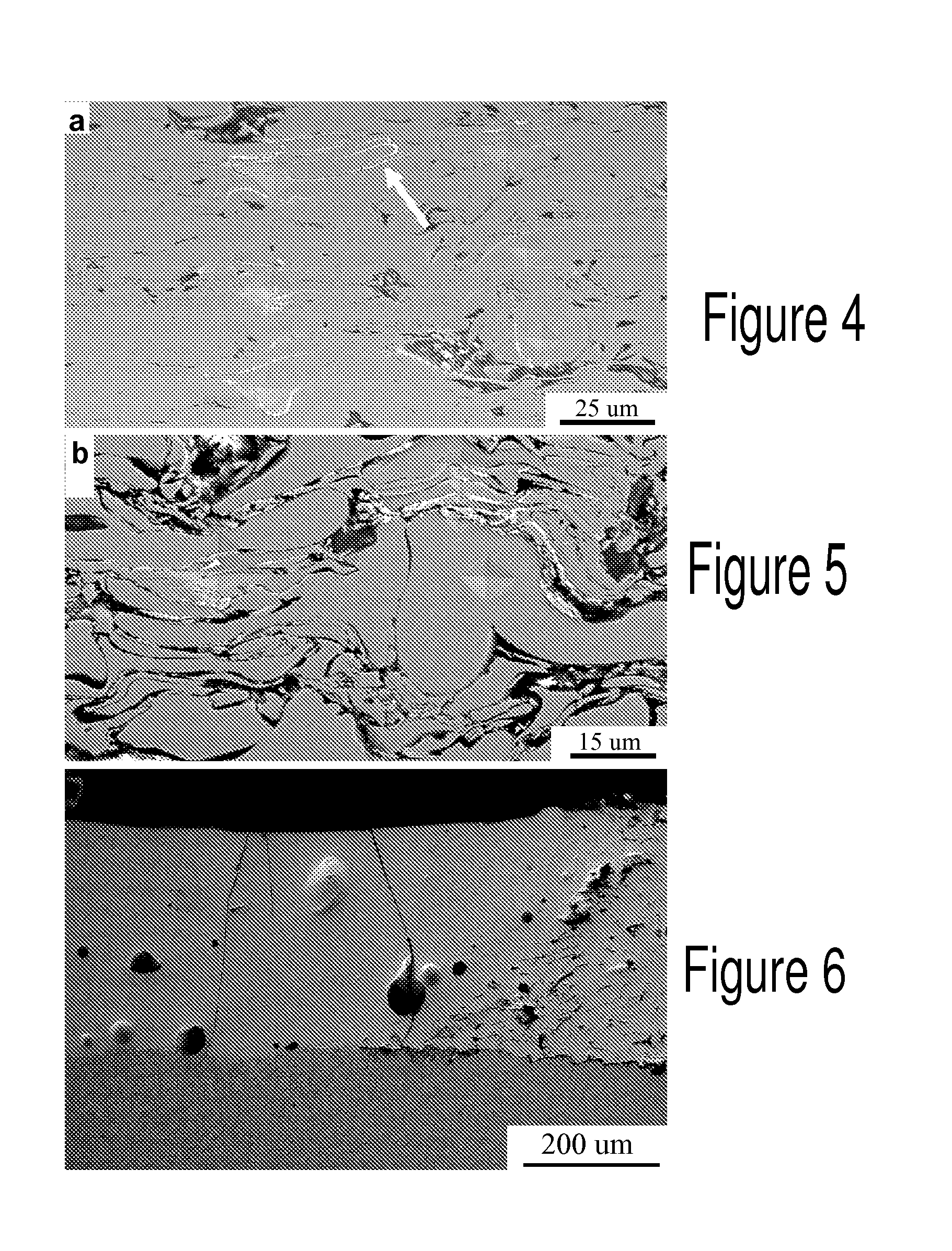 Surface Treatment of Amorphous Coatings