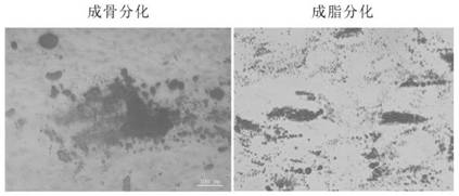 A mesenchymal stem cell for inhibiting tumor growth, preparation method and application thereof