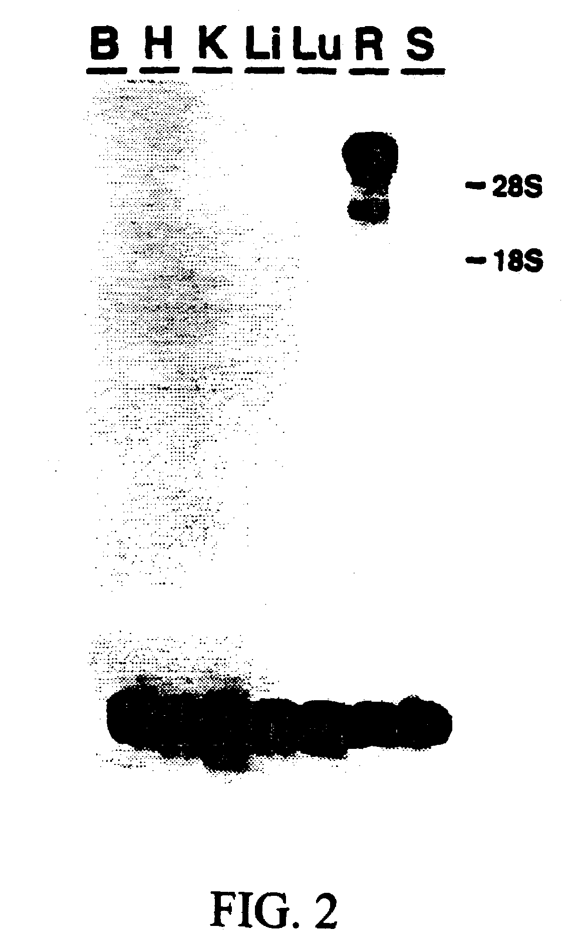 Nucleic acid and amino acid sequences for ATP-binding cassette transporter and methods of screening for agents that modify ATP-binding cassette transporter