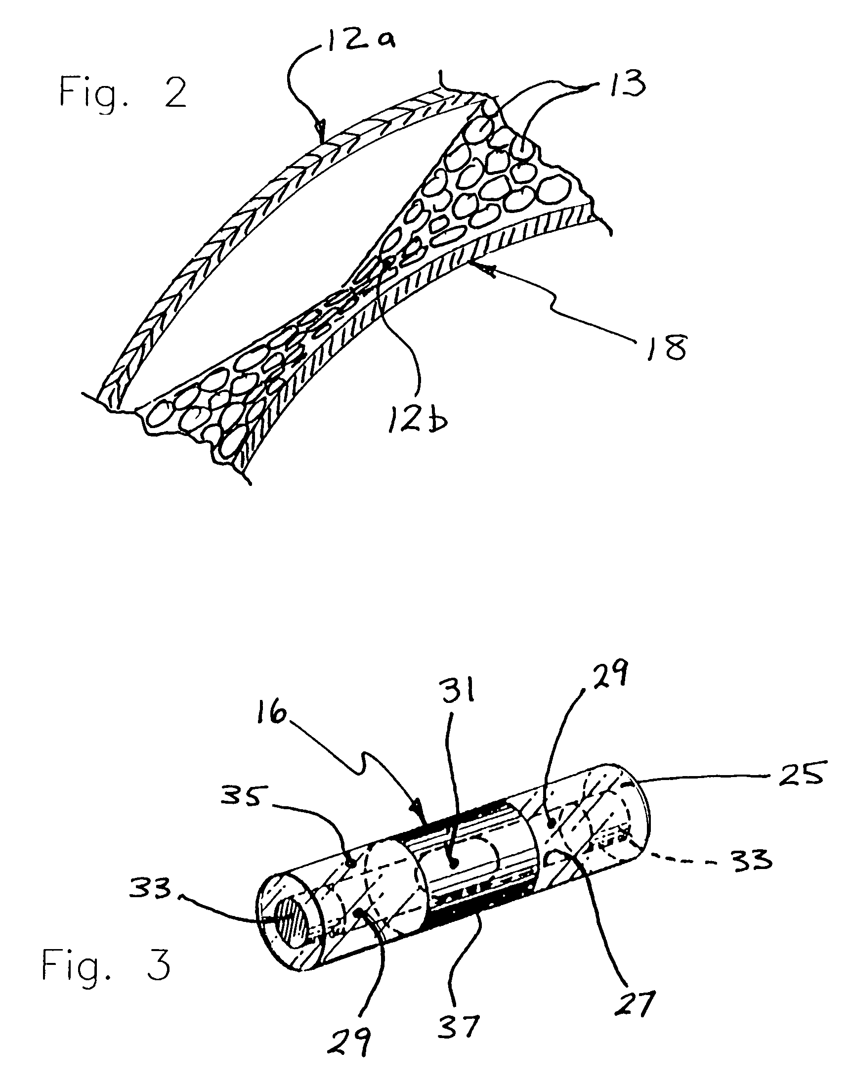 Helmet with shock detector, helmet attachment device with shock detector and methods