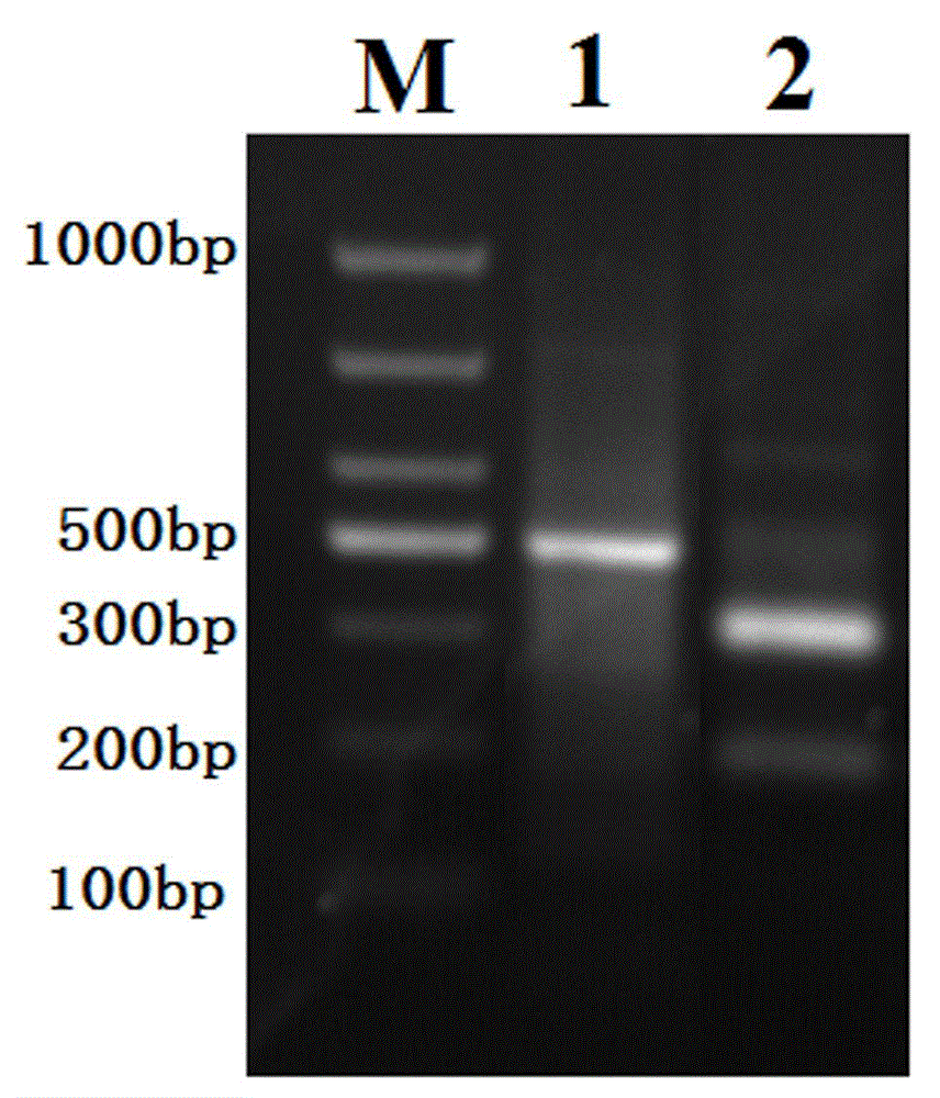 RUNX1 gene splitting and copy number increase detection kit and preparation method thereof