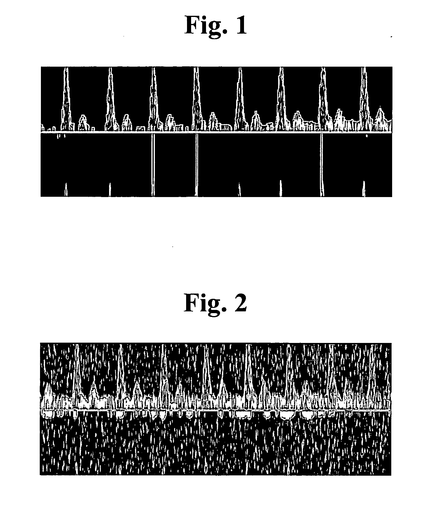 Apparatus and method for processing an ultrasound spectrum image