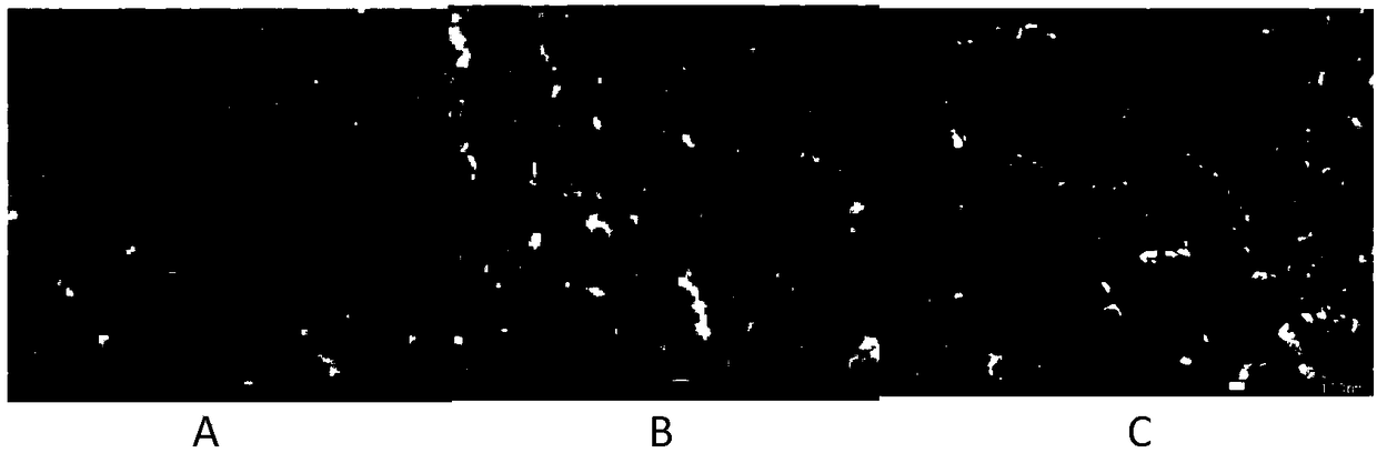 Preparation method for synthesizing MIL-53(Al)-AO2 on basis of metal-organic framework of amidoxime