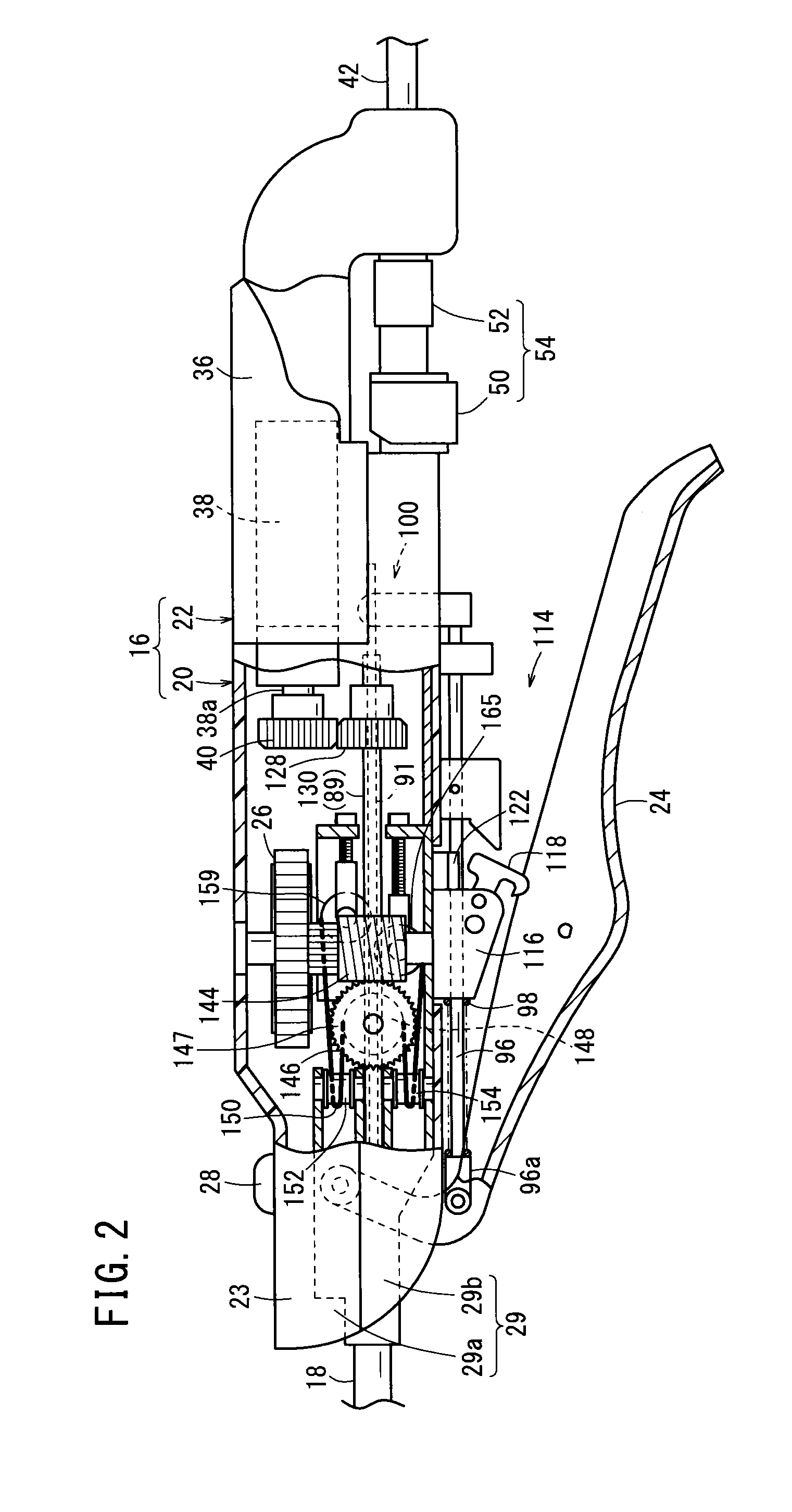 Suturing and ligating method