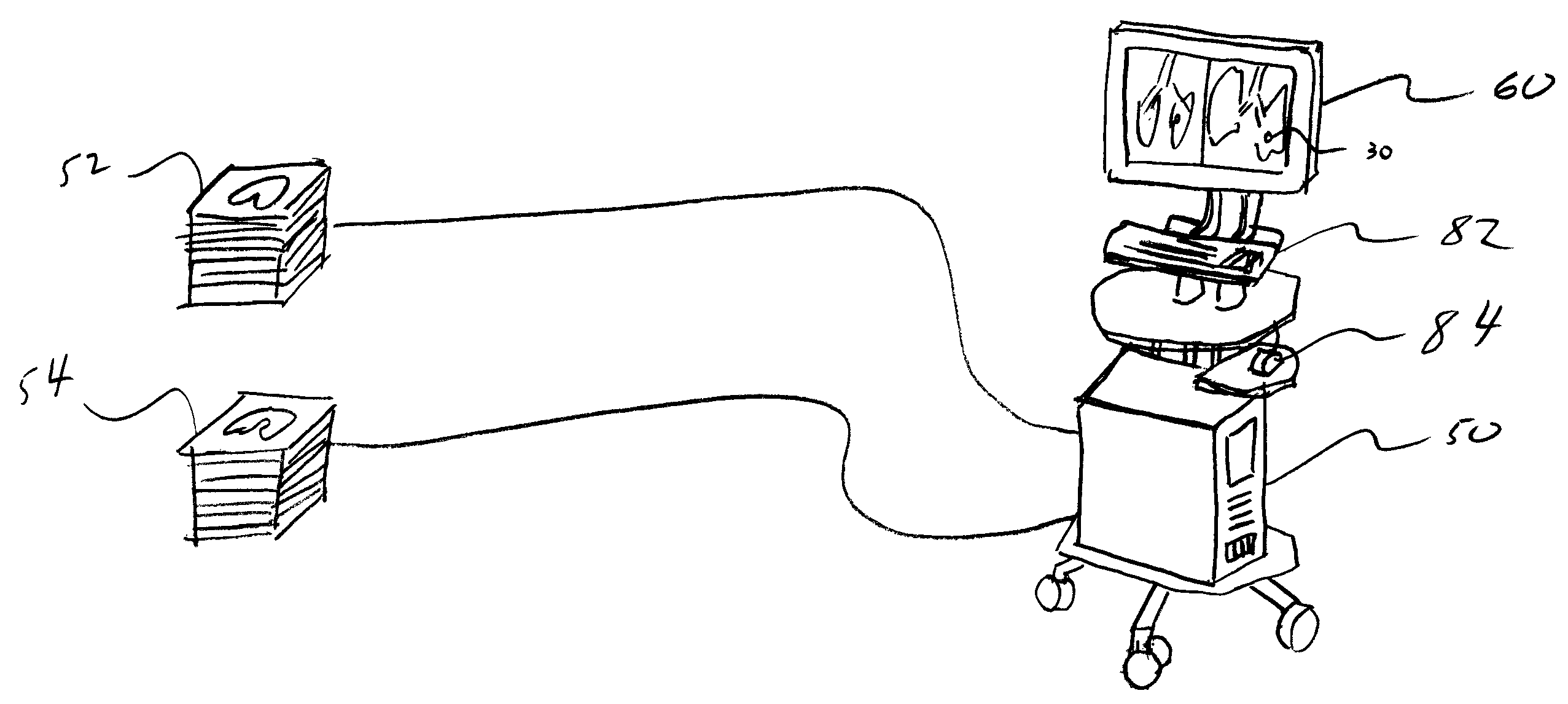 Surgical assistance planning method using lung motion analysis