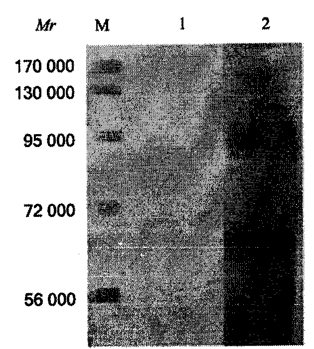 Chicken yolk antibody-magnetic bead ELISA (Enzyme-Linked Immuno Sorbent Assay) method for detecting schistosoma japonica circulating antigen