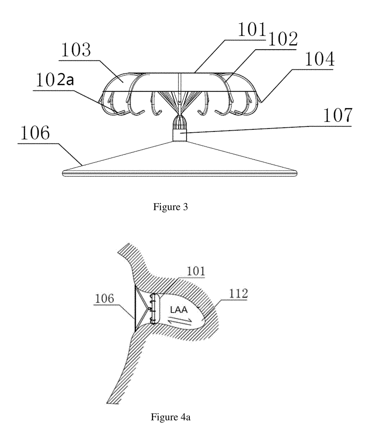 Left atrial appendage closure apparatus