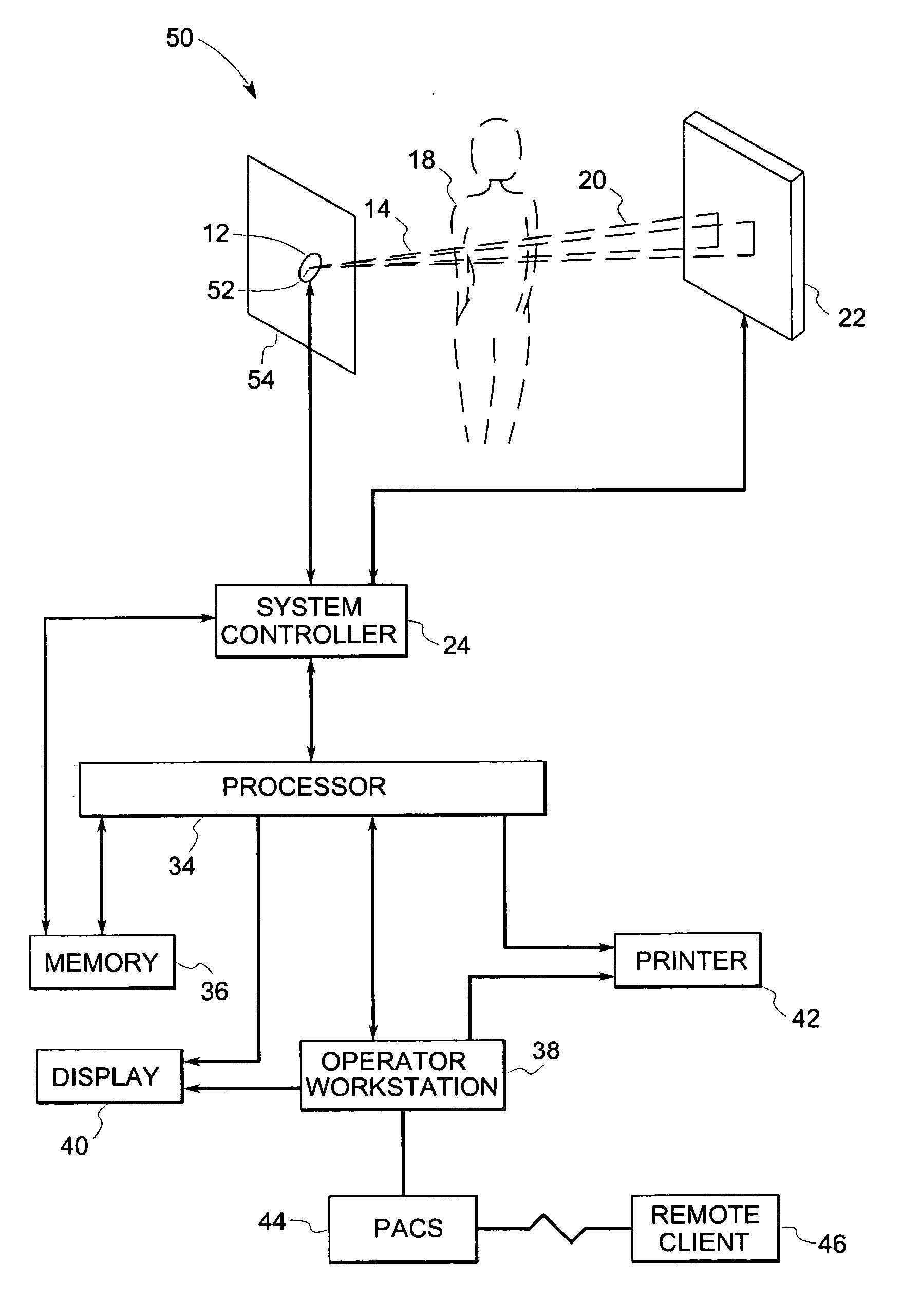 System and method for anatomy based reconstruction