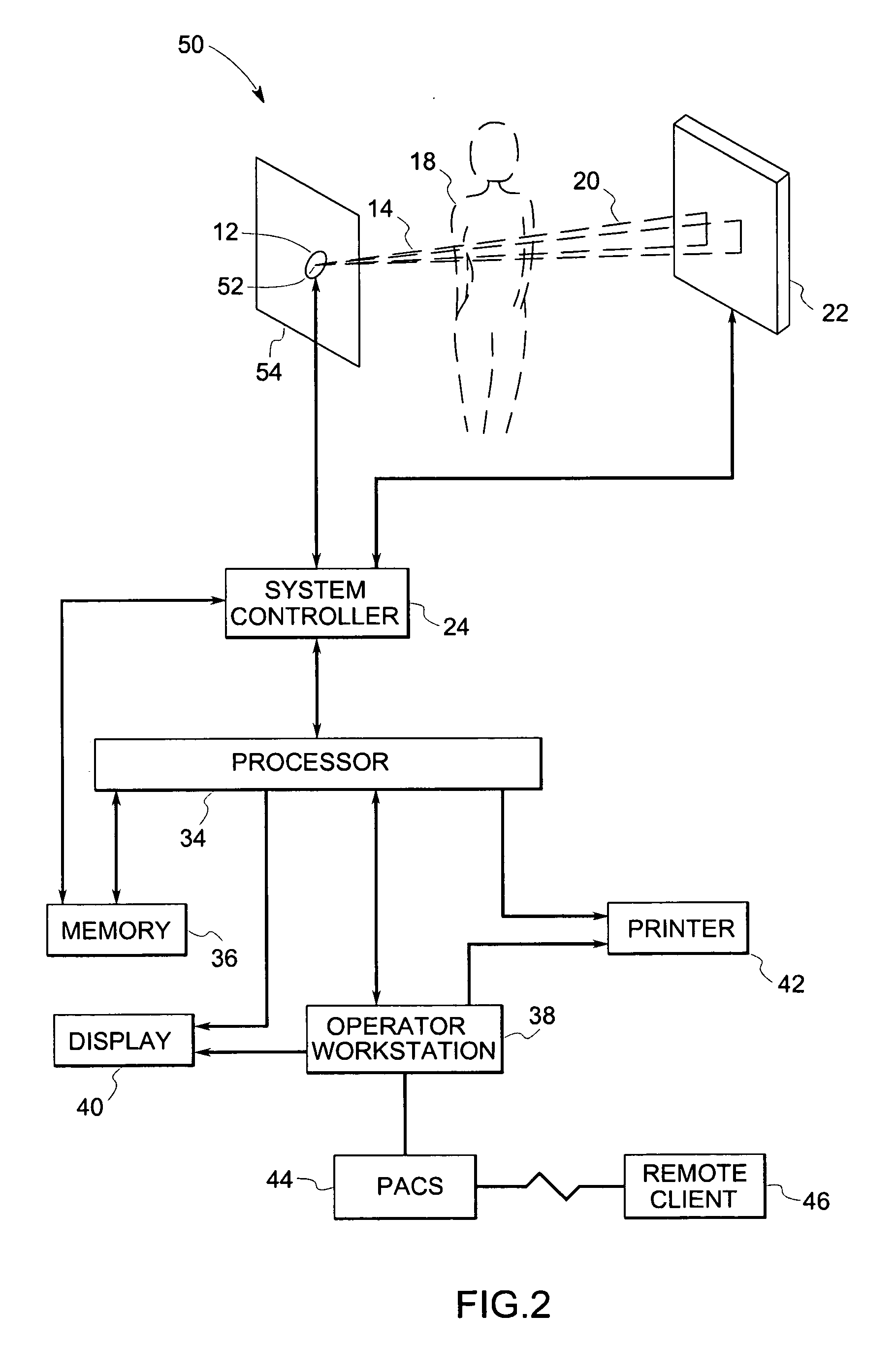 System and method for anatomy based reconstruction