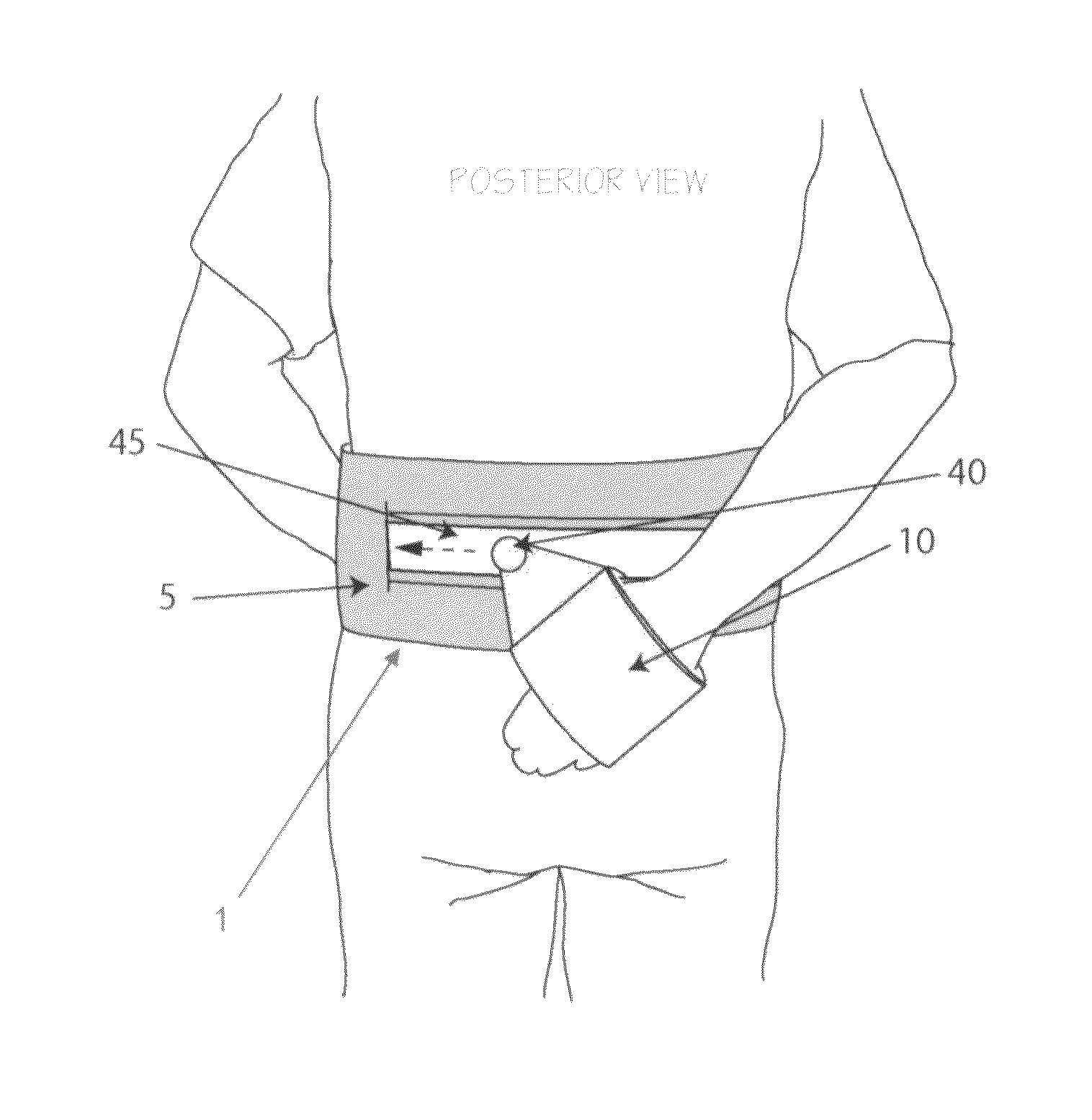 Method and apparatus for therapeutically supporting the arm of a patient