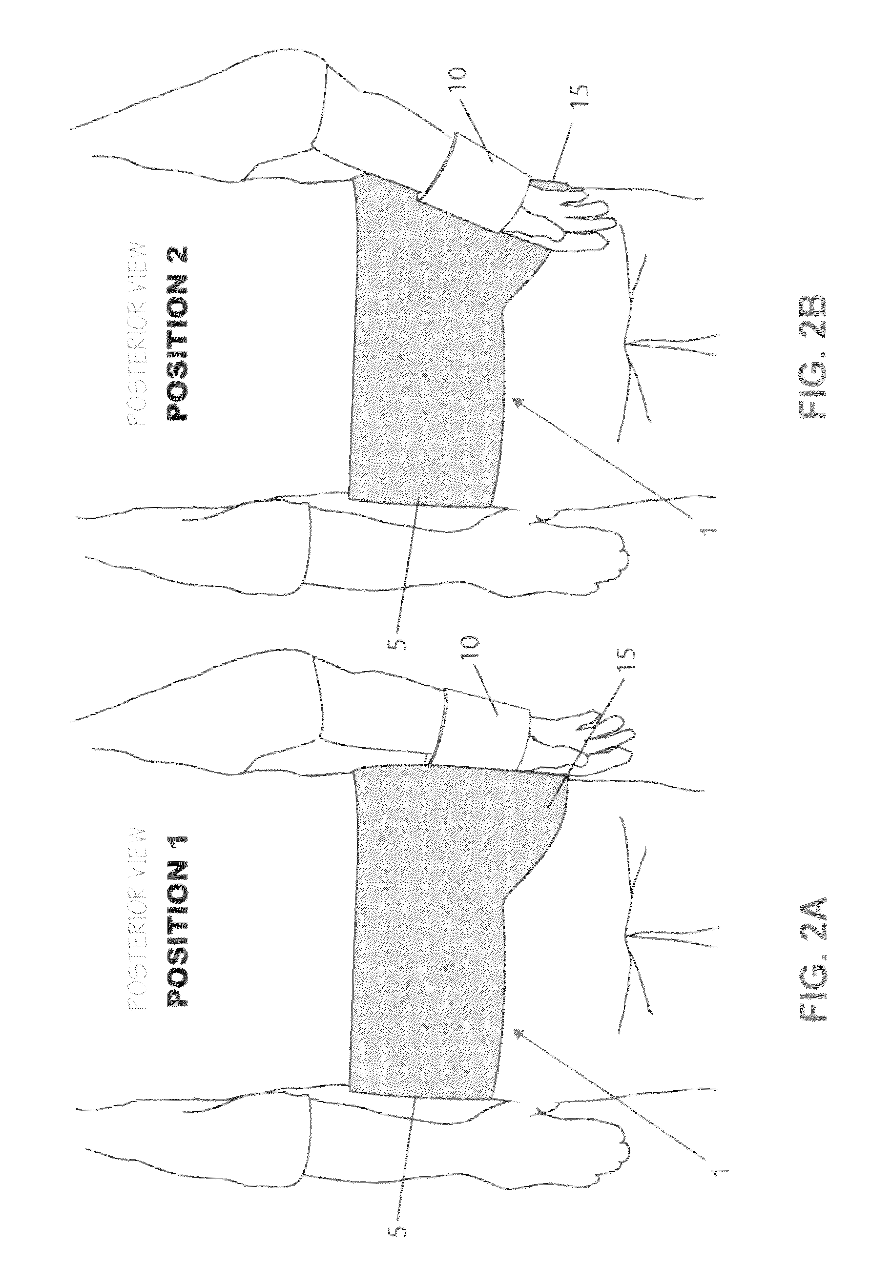 Method and apparatus for therapeutically supporting the arm of a patient