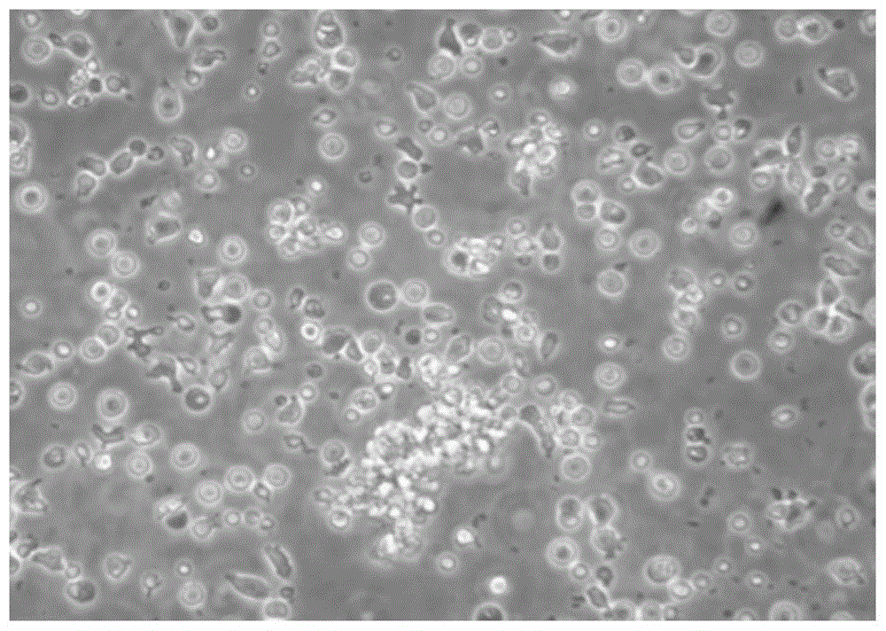 A kind of serum-free cryopreservation medium and cryopreservation method for peripheral blood mononuclear cells