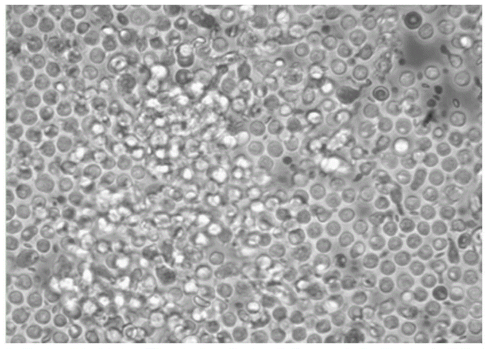 A kind of serum-free cryopreservation medium and cryopreservation method for peripheral blood mononuclear cells