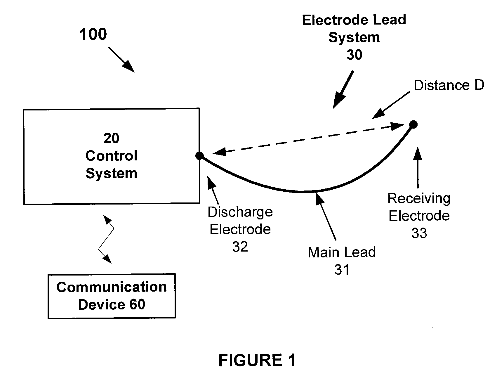 Atrial defibrillation using an implantable defibrillation system