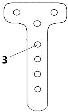 Orthopaedic medical instrument tibia bone fracture plate