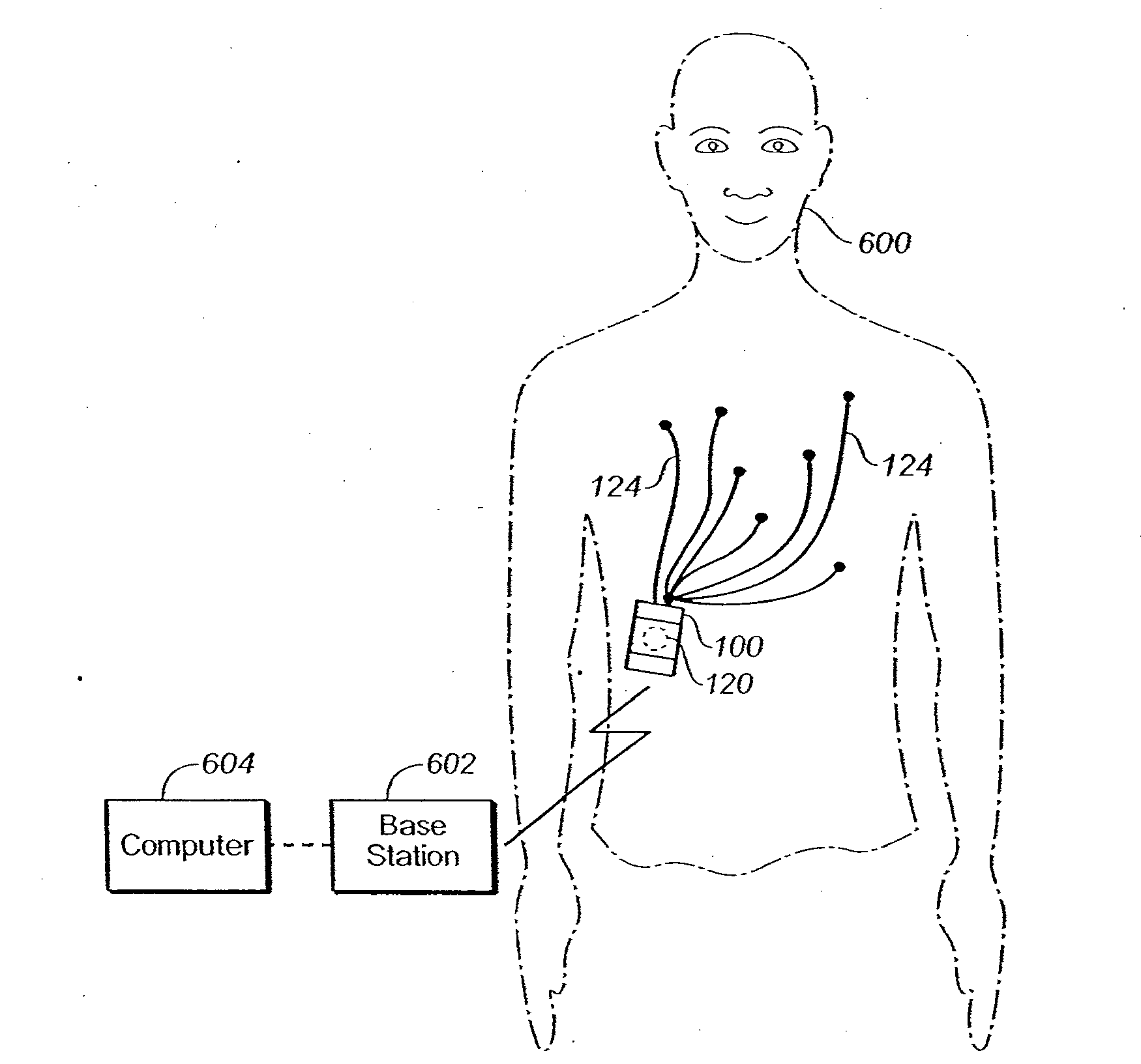 Portable cardiac monitor including RF communication