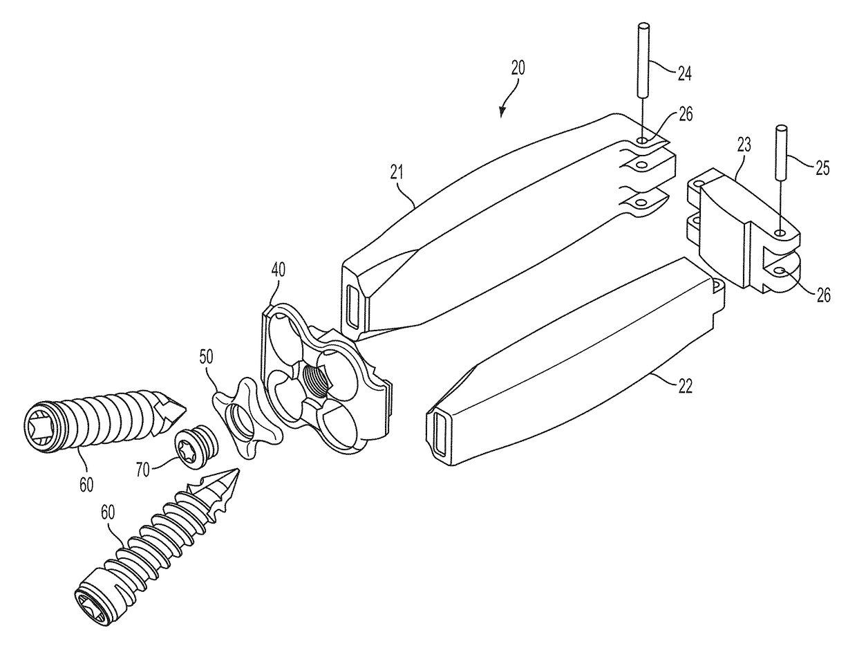 Interbody fusion device with separable retention component for lateral approach and associated methods