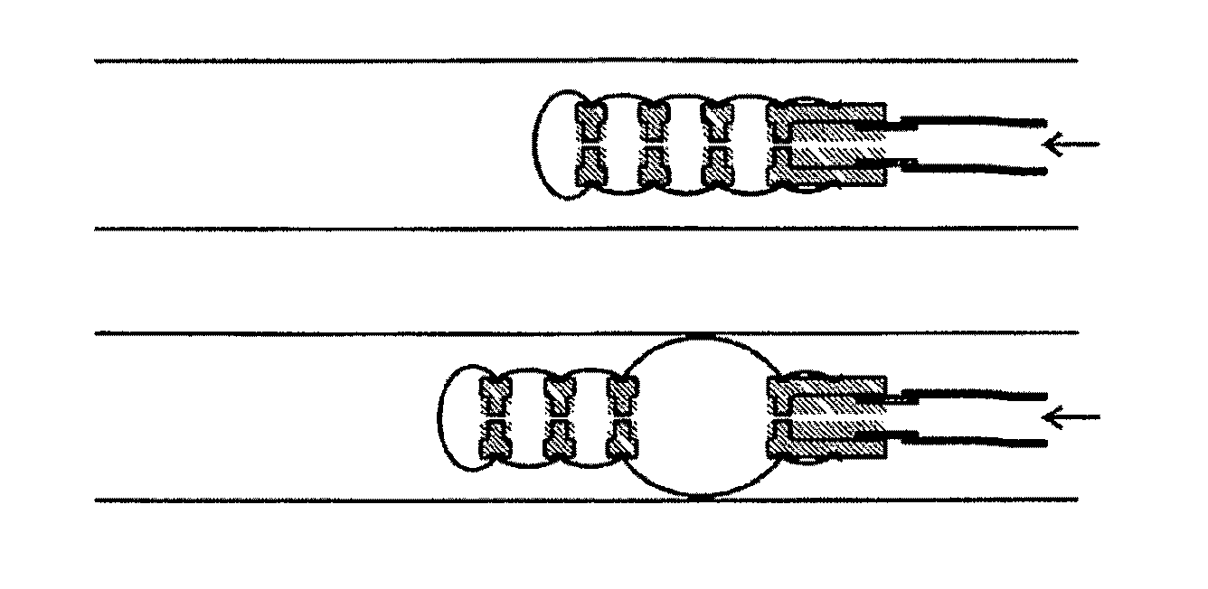 Inflatable balloon device and applications