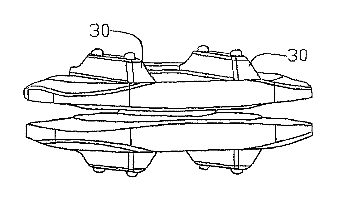 Motion restoring intervertebral device