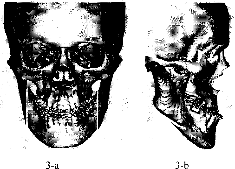 Prodn method of computer aid generating positioning board