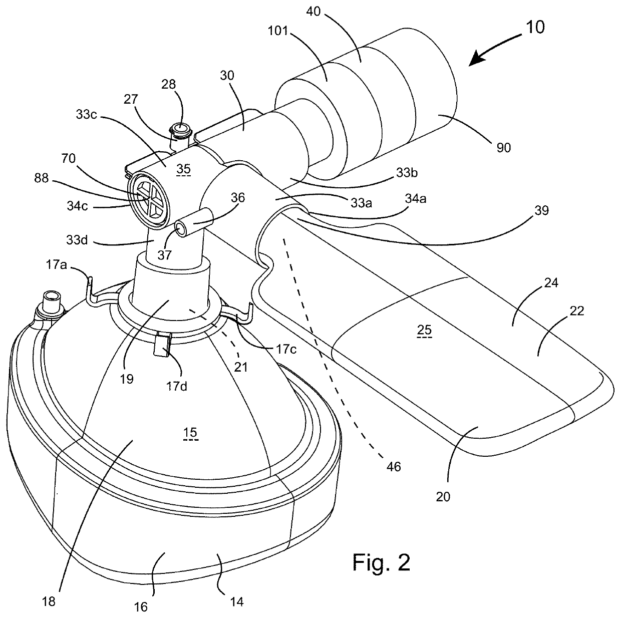 Methods of respiratory support and related apparatus