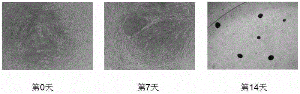 Composition for treating osteoarthritis as well as preparation method and application of composition