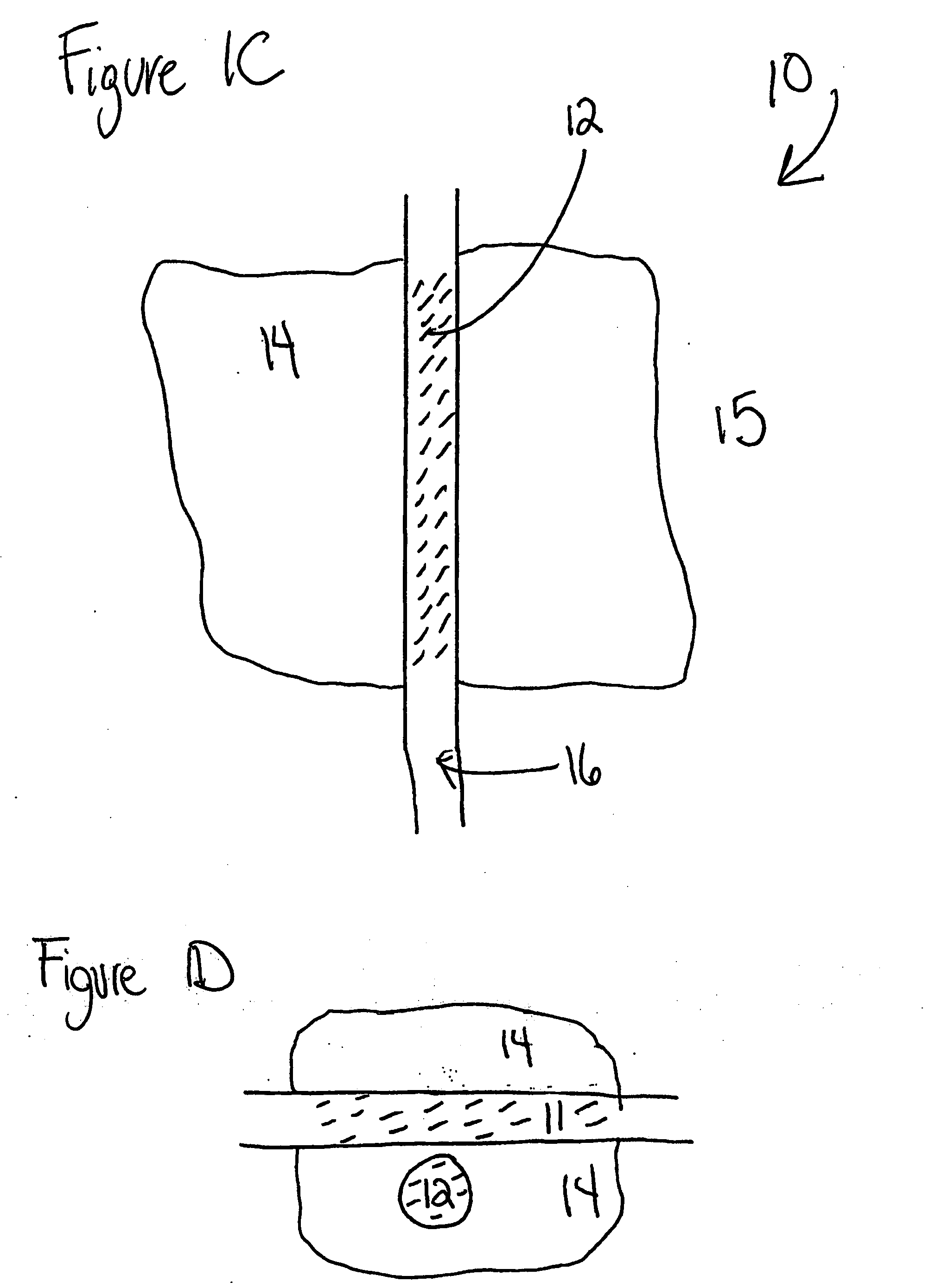 Aerobic and anaerobic waste management systems and methods for landfills