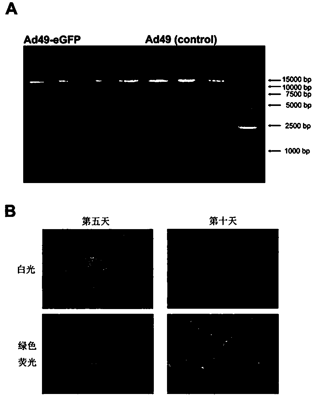 Recombinant adenovirus expression vector based on adenovirus HAd49 and construction method thereof