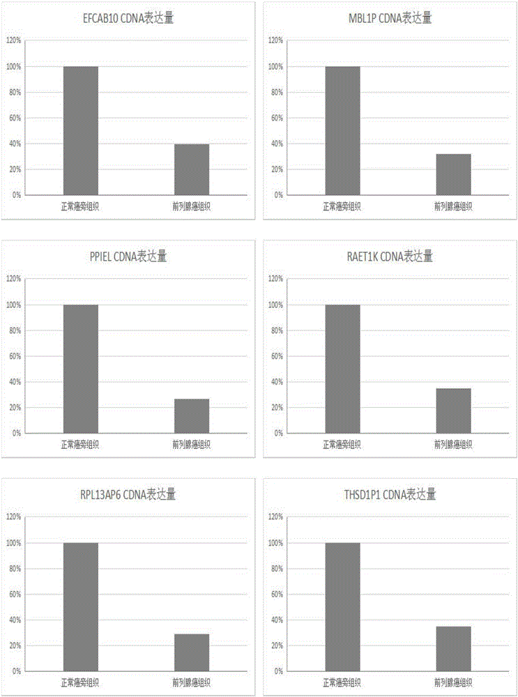 Biomarker of prostatic cancer