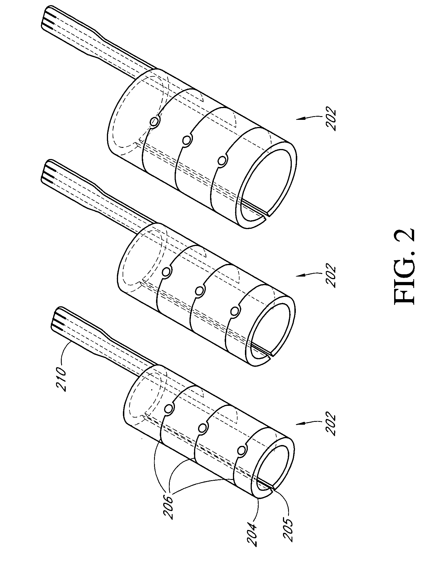 Implantable medical device with nerve signal sensing