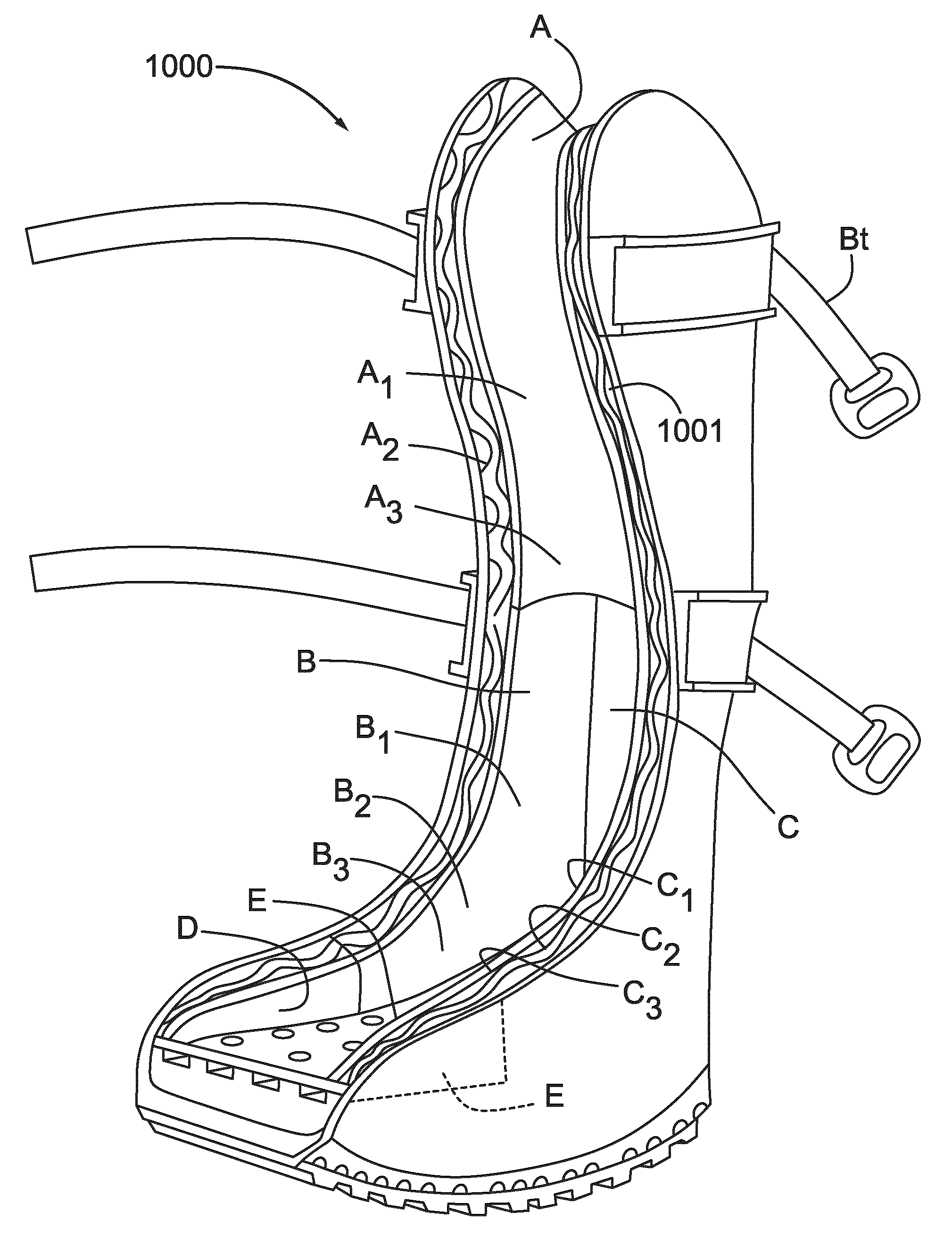 Porous orthopedic or prosthetic support having removable cushioning and scaffolding layers