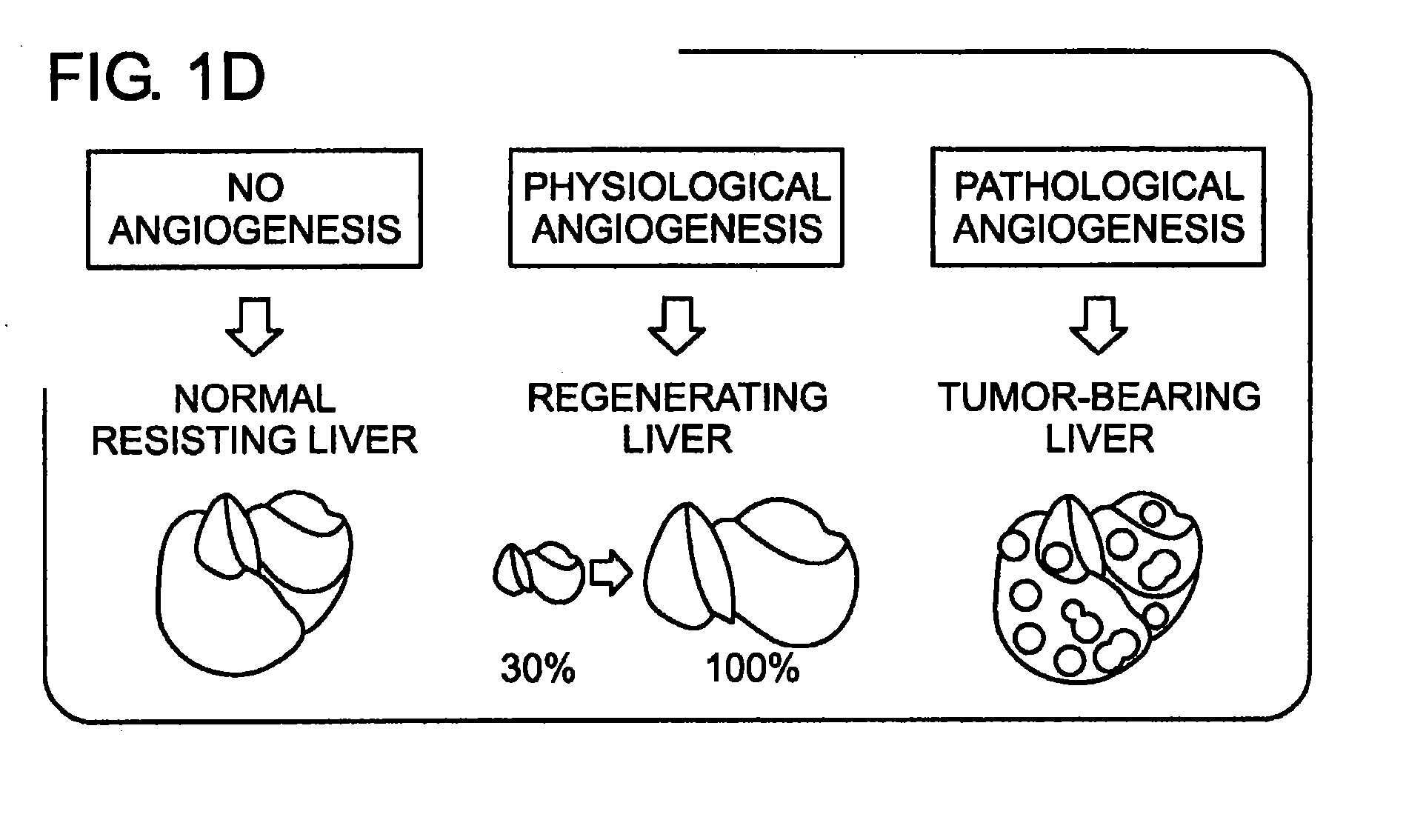 Differential gene expression in physiological and pathological angiogenesis