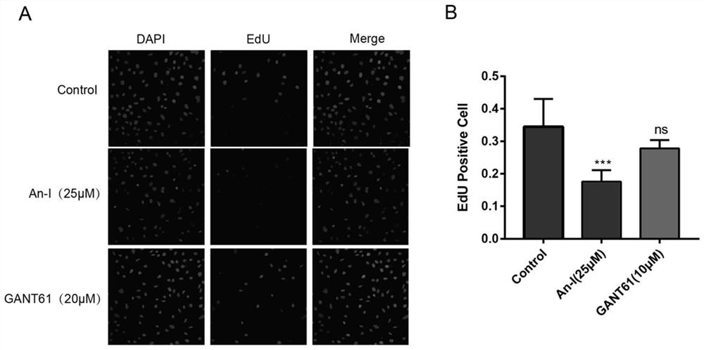 Application of a kind of timosaponin I in the preparation of anti-human ovarian cancer drug