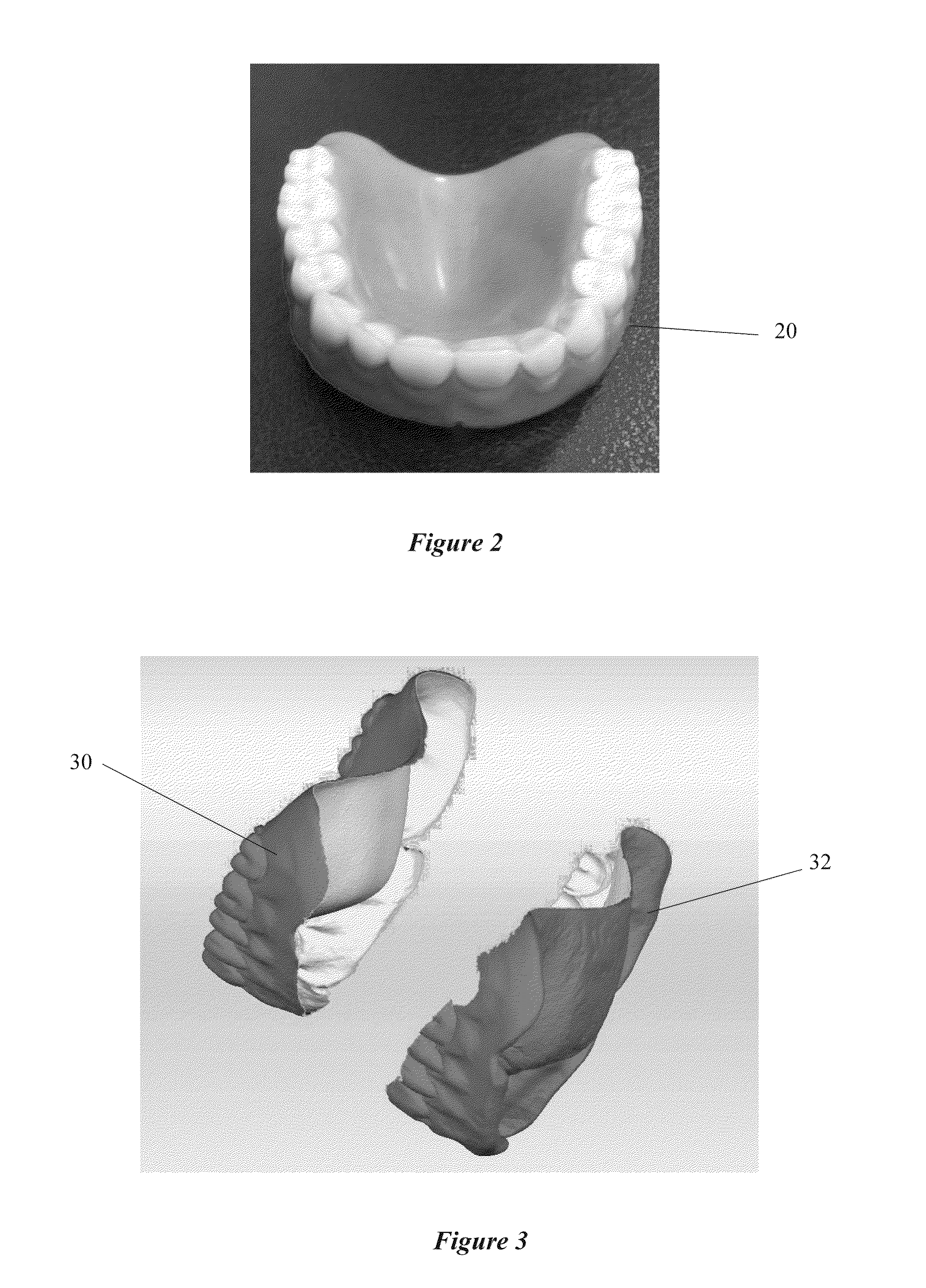 System and Process for Duplication of Dentures