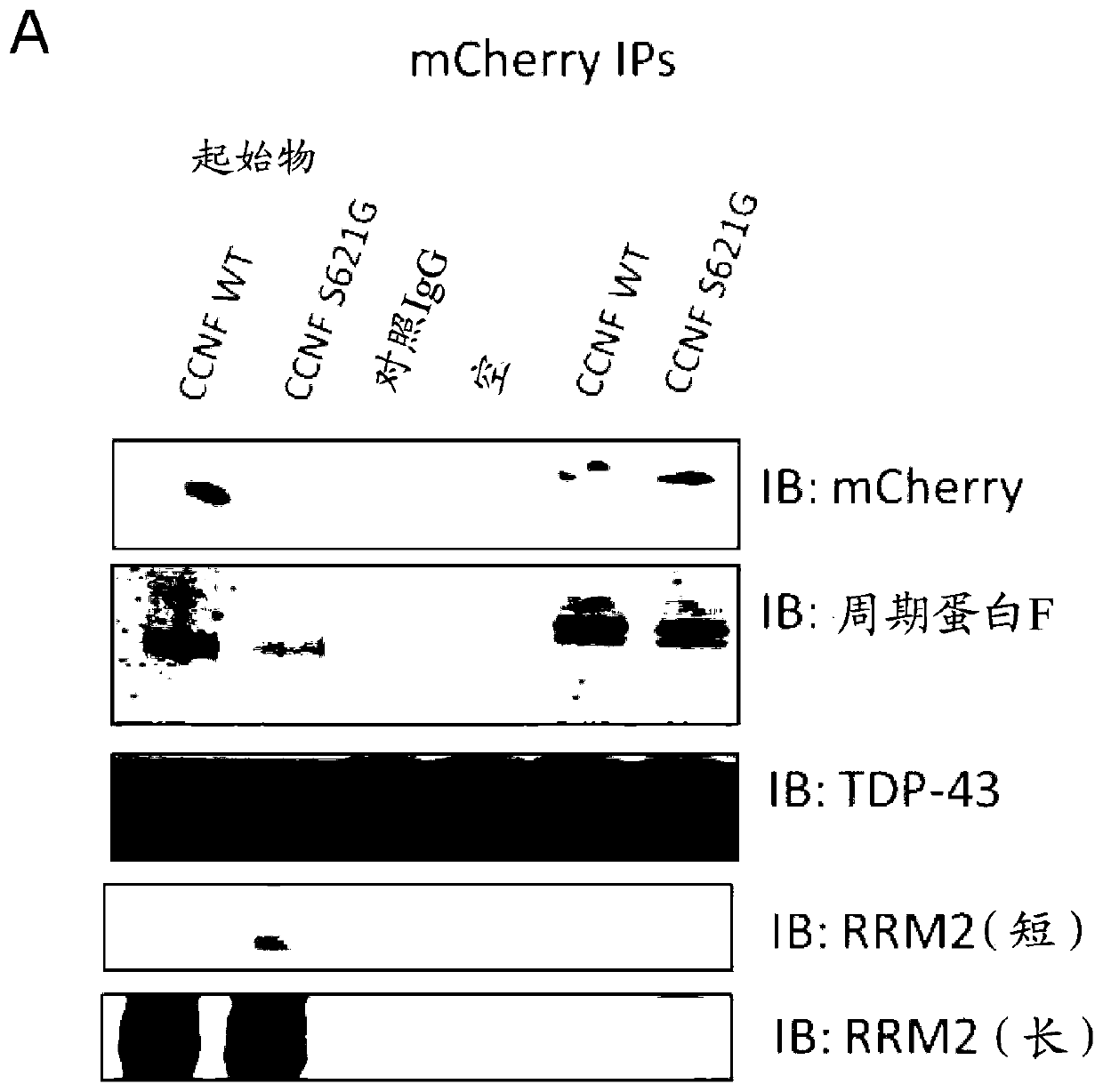 Modulation of protein accumulation and uses therefor