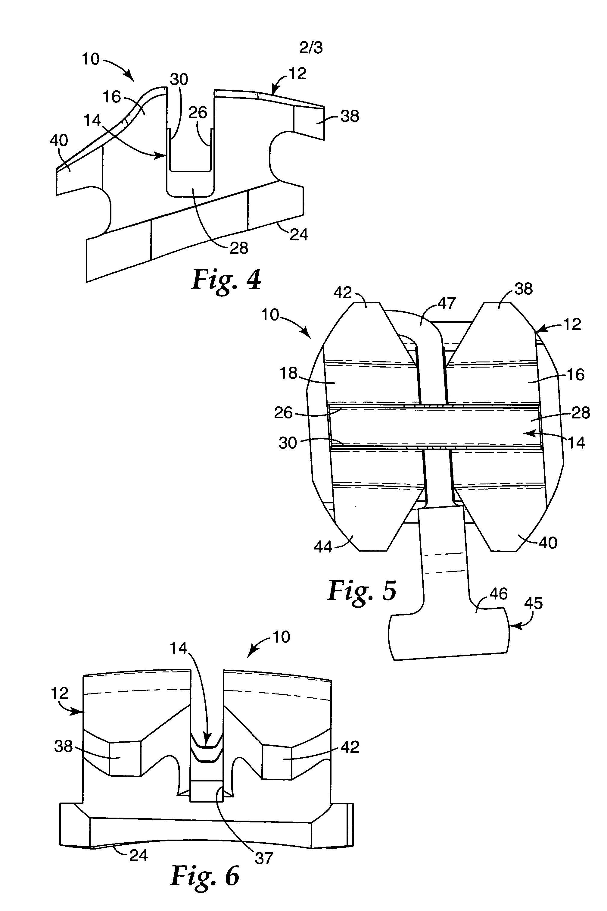 Ceramic orthodontic appliance with archwire slot liner