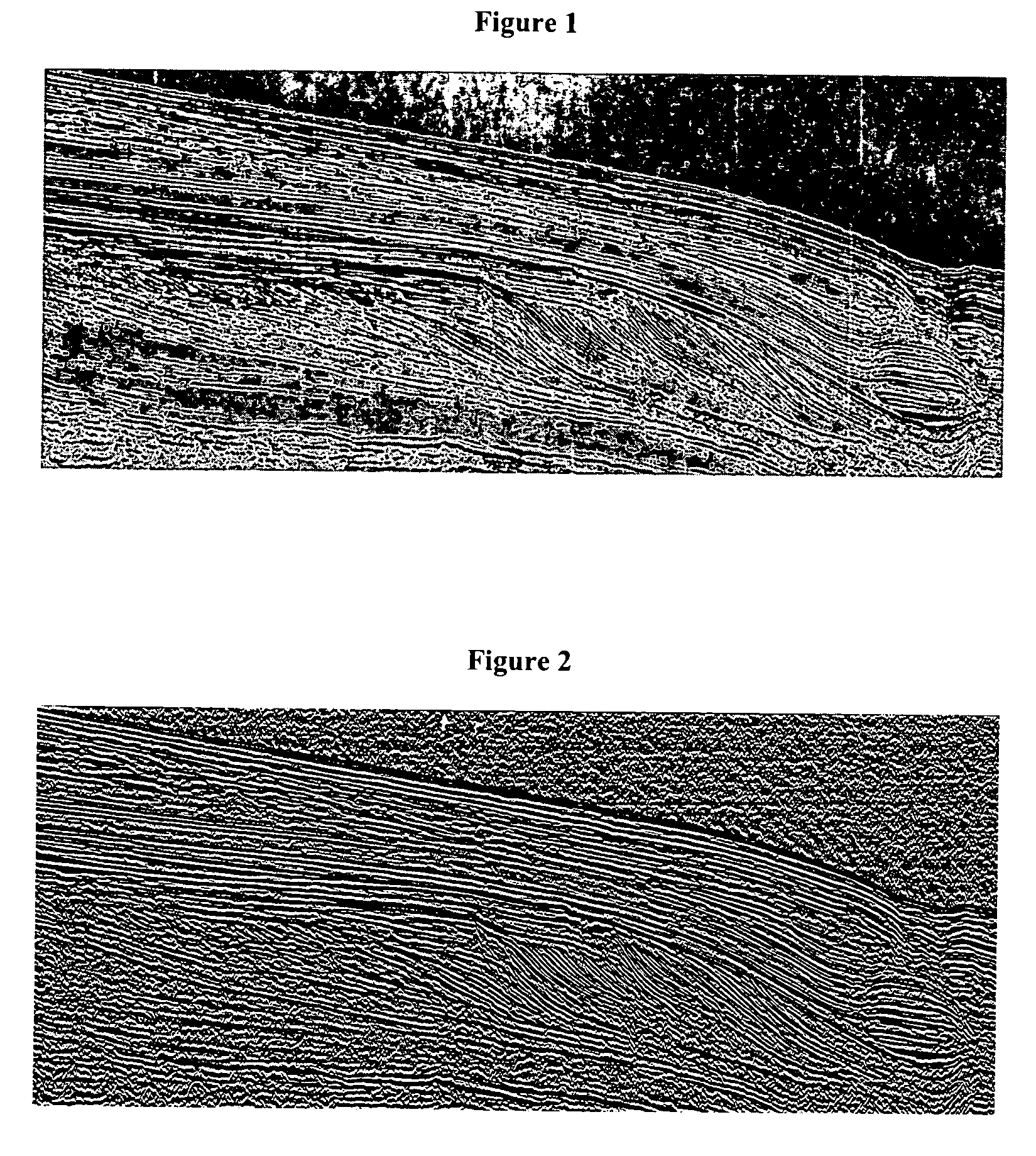 Method of sedimentologic interpretation by estimation of various chronological scenarios of sedimentary layers deposition