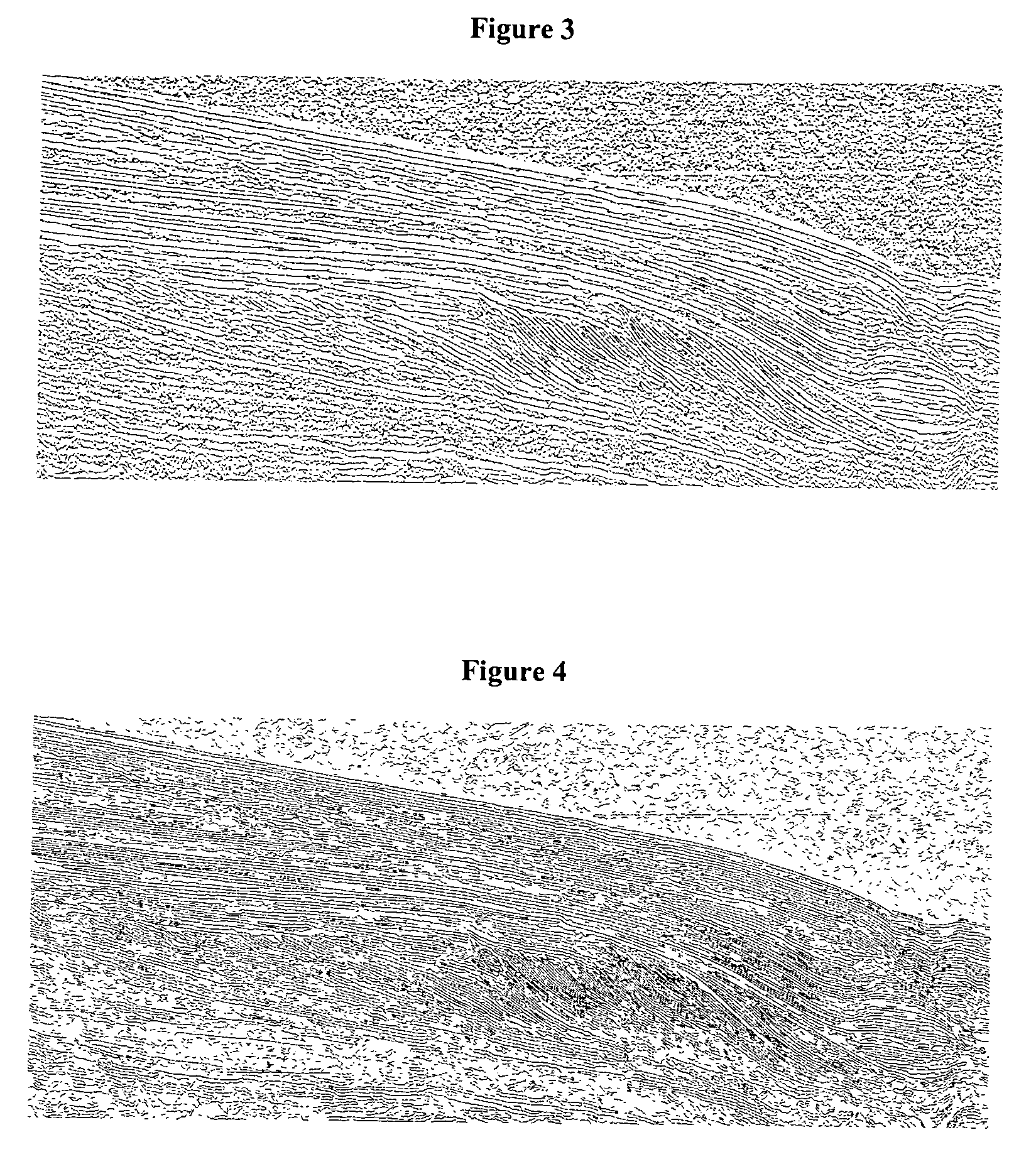 Method of sedimentologic interpretation by estimation of various chronological scenarios of sedimentary layers deposition