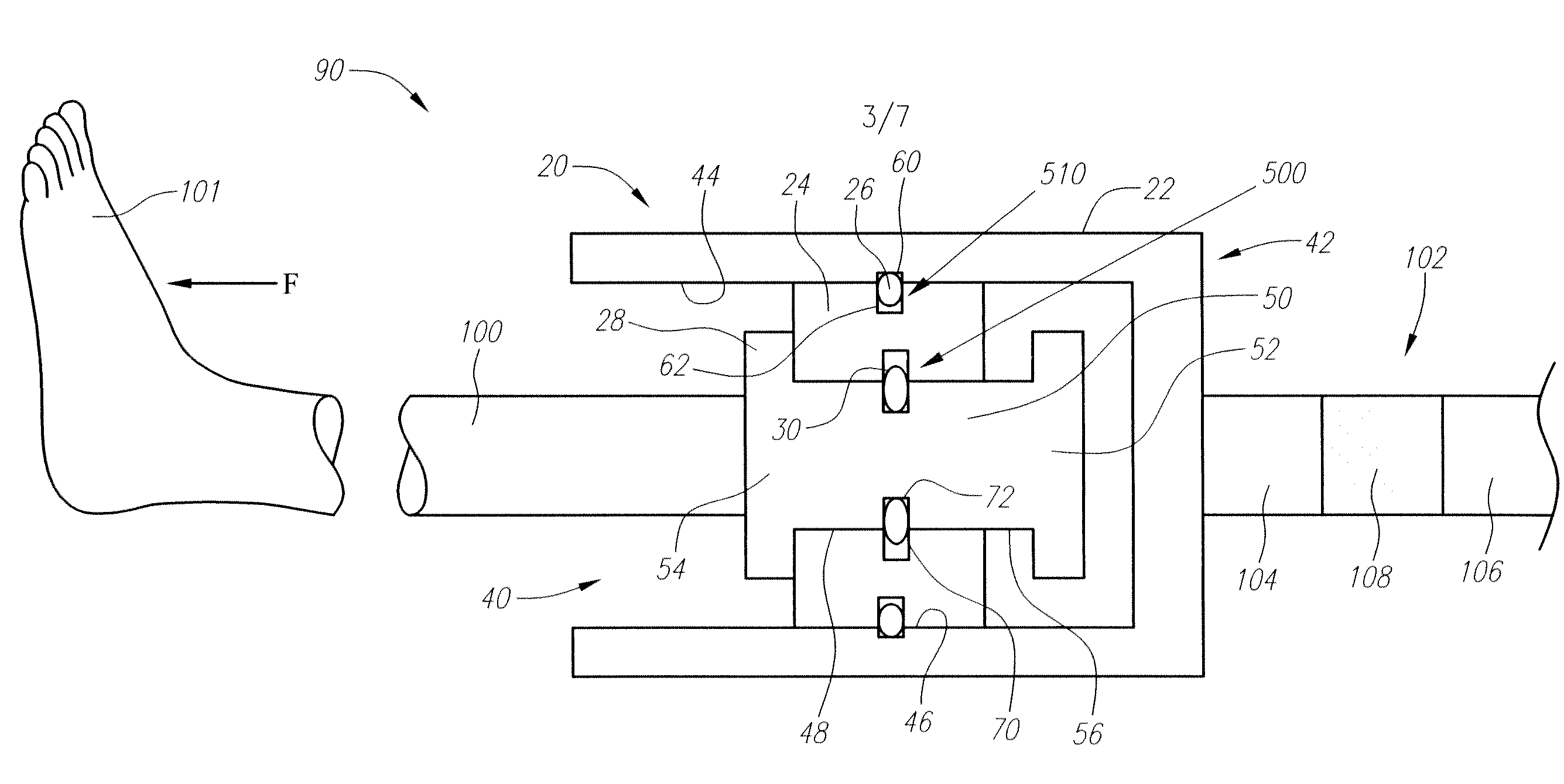 Multi-stage engagement assemblies and related methods