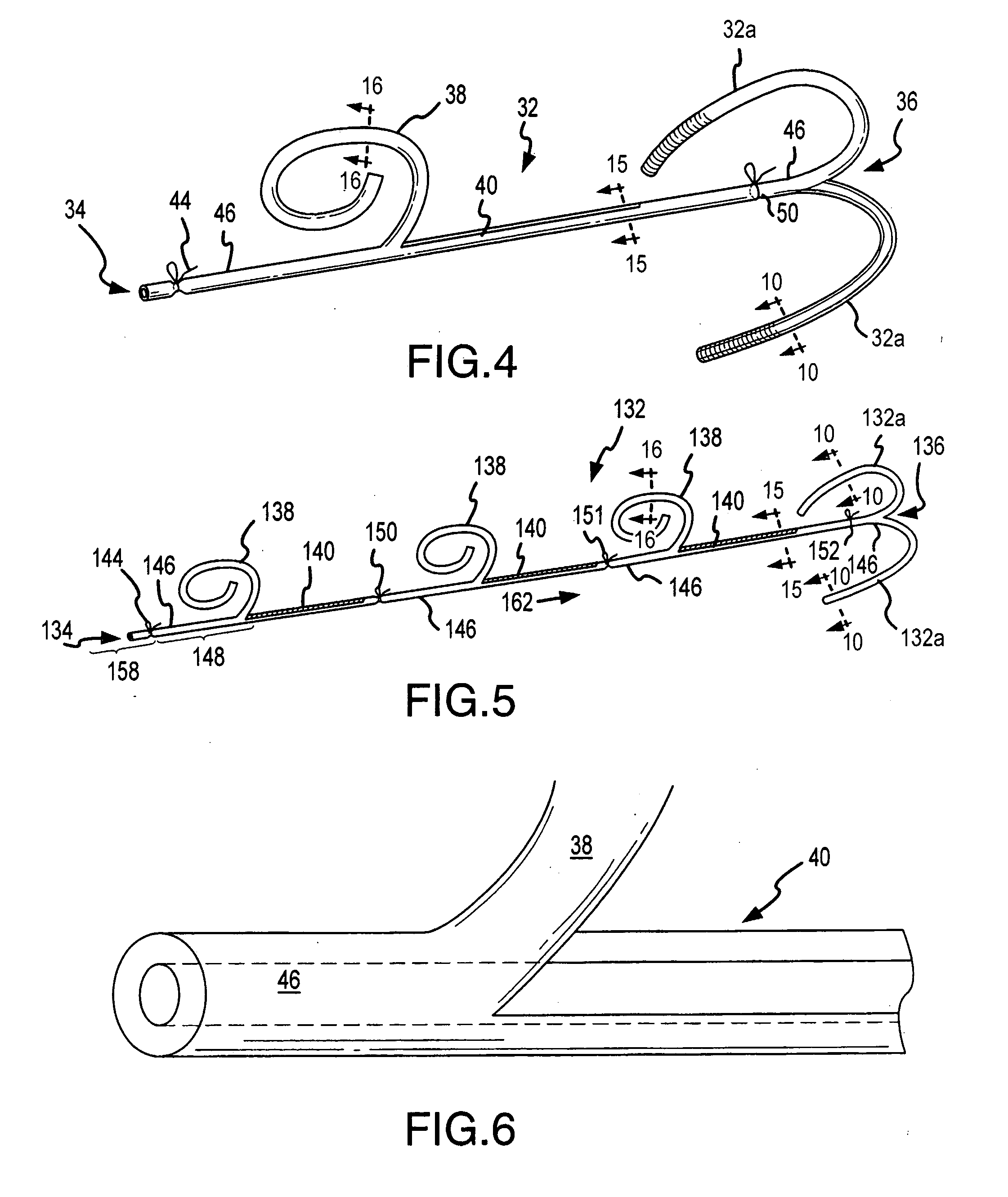 C-shaped cross section tubular ophthalmic implant for reduction of intraocular pressure in glaucomatous eyes and method of use