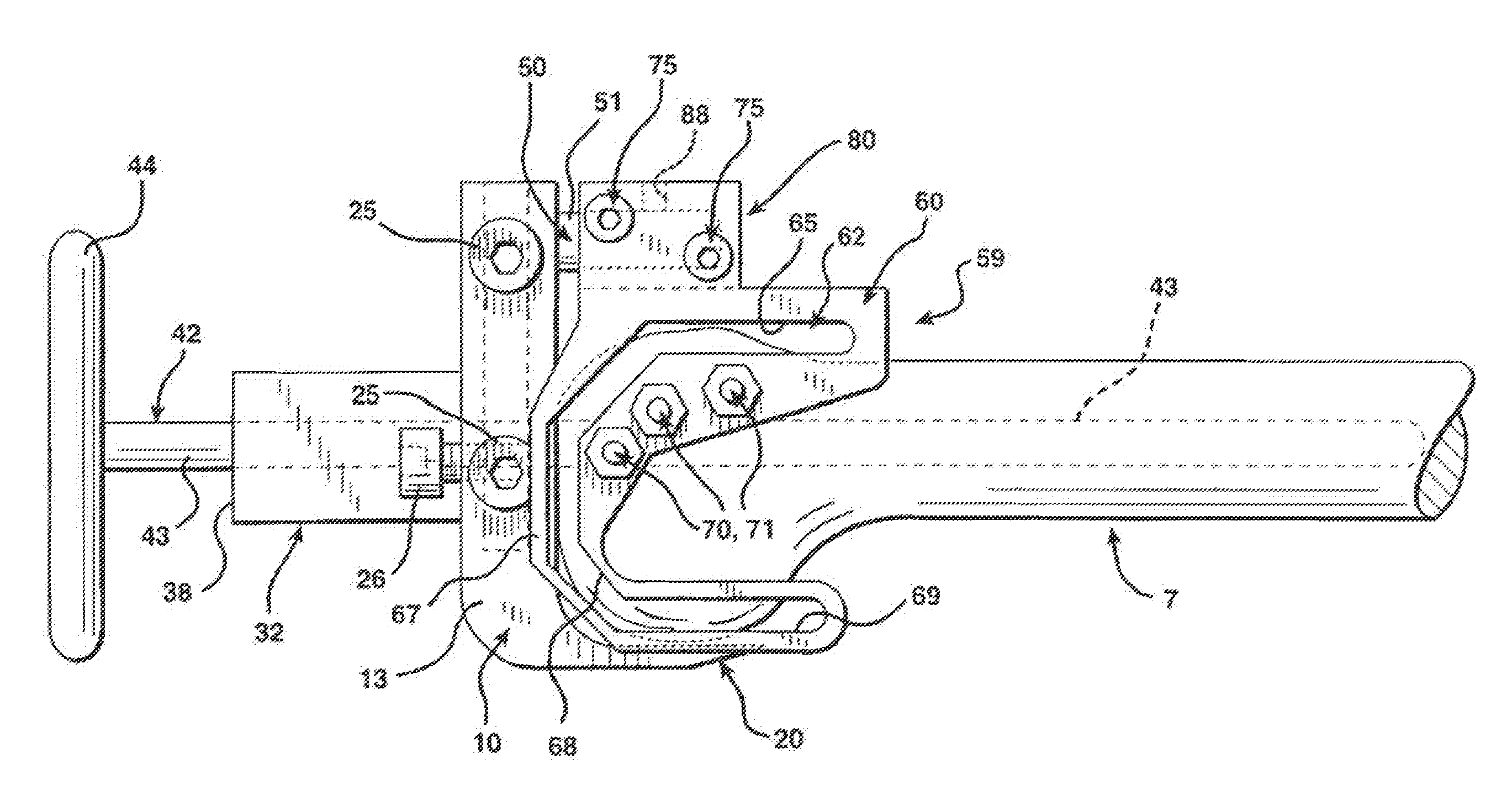 Methods and apparatus for knee arthroplasty