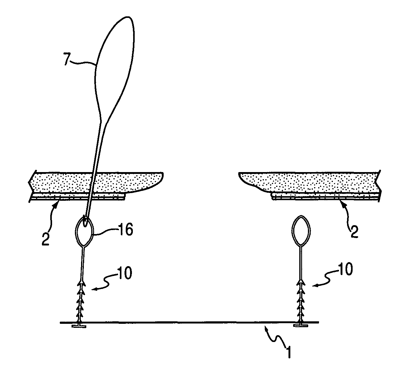 Device and method for tacking a prosthetic screen